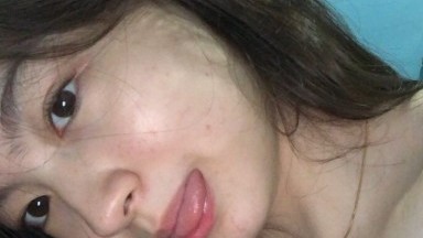 Rosalyn Sphinx yang memakai kawat gigi mengalami orgasme saat vaginanya